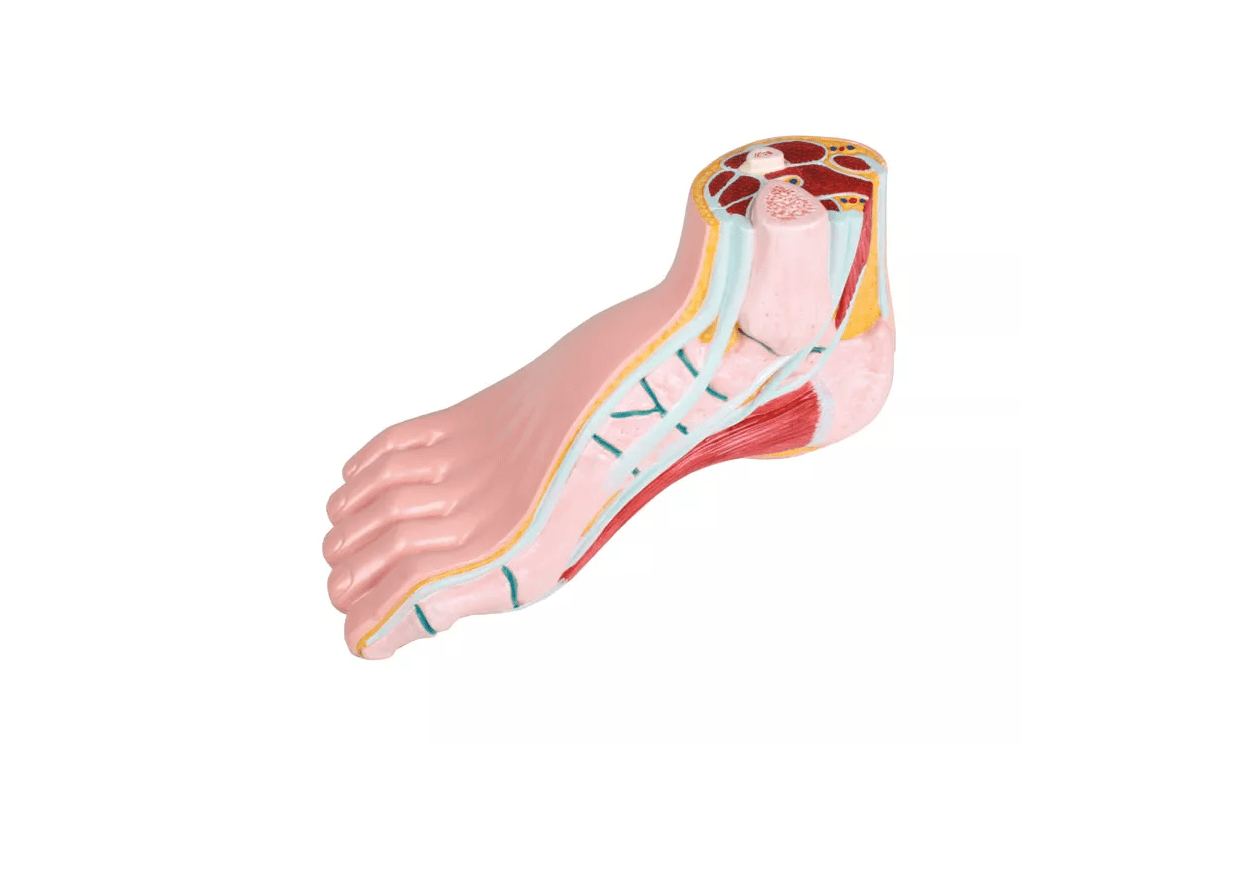 Hohlfuß, pes cavus - Erler - Zimmer